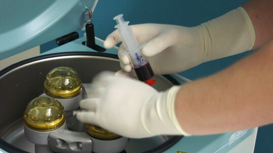 LÉČBA KREVNÍ PLAZMOU. KDY JE VHODNÁ A KDY NE?