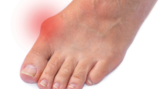 HALLUX VALGUS, ANEB LODIČKY NEBO ŽABKY?