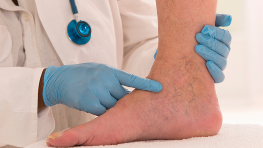 VYŠETŘENÍ CÉVNÍHO SYSTÉMU